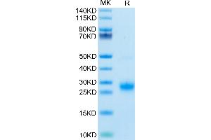 Biotinylated Human GITR on Tris-Bis PAGE under reduced condition. (TNFRSF18 Protein (AA 26-161) (His-Avi Tag,Biotin))