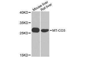 Western blot analysis of extracts of various cell lines, using MT-CO3 antibody. (COX3 Antikörper  (AA 1-100))