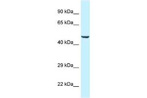 WB Suggested Anti-C9orf156 Antibody Titration: 1. (C9orf156 Antikörper  (Middle Region))