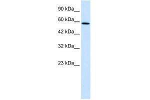 WB Suggested Anti-TBC1D10B Antibody Titration:  1. (TBC1D10B Antikörper  (C-Term))