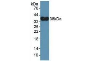 Detection of Recombinant DEFa4, Human using Polyclonal Antibody to Defensin Alpha 4, Corticostatin (DEFa4) (DEFA4 Antikörper  (AA 23-97))