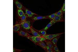 Immunofluorescence analysis of 3T3-L1 cells using EEF2 mouse mAb (green). (EEF2 Antikörper)
