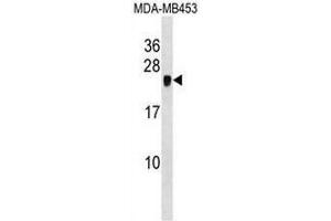 CRIP2 Antibody (C-term) western blot analysis in MDA-MB453 cell line lysates (35µg/lane). (CRIP2 Antikörper  (C-Term))