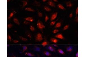 Immunofluorescence analysis of NIH/3T3 cells using ENO3 Polyclonal Antibody at dilution of 1:100. (ENO3 Antikörper)