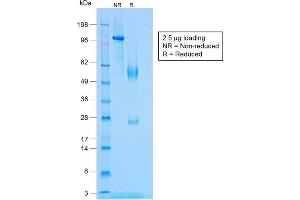SDS-PAGE Analysis Purified TNF alpha Rabbit Recombinant Monoclonal Antibody (TNF/1500R). (Rekombinanter TNF alpha Antikörper)