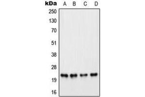 Western blot analysis of PARP1 expression in HeLa PMA-treated (A), Raw264. (PARP1 Antikörper  (Center))
