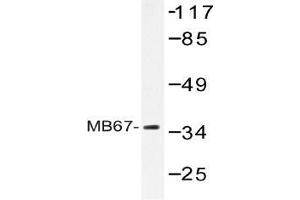 Western blot (WB) analysis of MB67 antibody in extracts from Jurkat cells. (NR1I3 Antikörper)