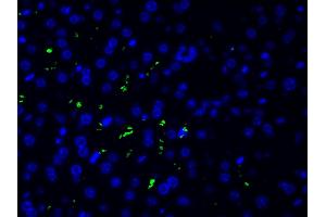 ABIN6261455 and ABIN6277691 at 1/200 staining human liver tissue cells by ICC/IF. (Ephrin B2 Antikörper  (C-Term))