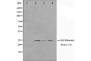 Western blot analysis on K562,Jurkat and 293 cell lysate using RPL10 Antibody.