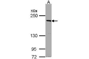 WB Image Sample (30μg whole cell lysate) A:Raji , 5% SDS PAGE antibody diluted at 1:1000 (PASK Antikörper  (C-Term))