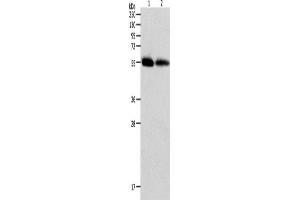 Western Blotting (WB) image for anti-Matrix Metallopeptidase 11 (Stromelysin 3) (MMP11) antibody (ABIN2426224) (MMP11 Antikörper)