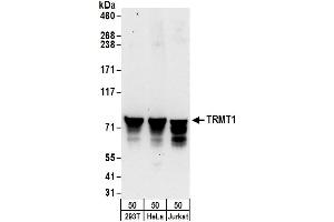 anti-tRNA Methyltransferase 1 (TRMT1) (AA 25-75) antibody