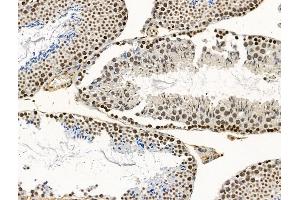 CCDC28A Antibody at 1/100 staining Mouse testis tissue by IHC-P.