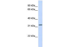 WB Suggested Anti-APTX Antibody Titration:  0.