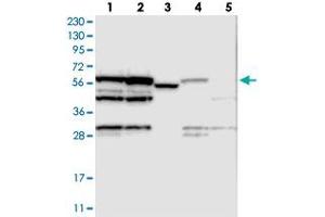 Western blot analysis of Lane 1: RT-4, Lane 2: U-251 MG, Lane 3: Human Plasma, Lane 4: Liver, Lane 5: Tonsil with MPP6 polyclonal antibody . (MPP6 Antikörper)