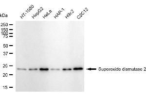 Western blotting analysis using Superoxide dismutase 2 antibody (ABIN7800463).