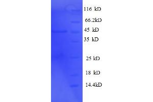 SDS-PAGE (SDS) image for Carbonic Anhydrase II (CA2) (AA 2-260) protein (His-SUMO Tag) (ABIN5709177)