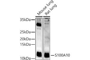 Western blot analysis of extracts of various cell lines, using S100 antibody (ABIN3015803, ABIN3015804, ABIN3015805, ABIN1682607 and ABIN6219148) at 1:400 dilution. (S100A10 Antikörper  (AA 1-97))