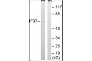 Western blot analysis of extracts from NIH-3T3 cells, using EIF3D Antibody. (EIF3D Antikörper)