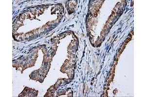 Immunohistochemical staining of paraffin-embedded prostate tissue using anti-PRKAR2A mouse monoclonal antibody. (PRKAR2A Antikörper)