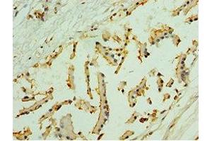 Immunohistochemistry of paraffin-embedded human prostate tissue using ABIN7161326 at dilution of 1:100