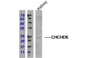 Lane 1: (mouse)Kidney lysates, probed with CHCHD6 Polyclonal Antibody, Unconjugated (Catalog # at 1:300 overnight at 4˚C. (CHCHD6 Antikörper  (AA 135-235))