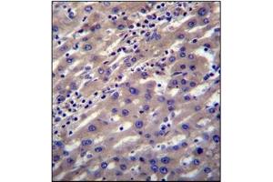 Immunohistochemistry analysis in Formalin Fixed, Paraffin Embedded Human liver tissue stained with SCP2 Antibody (N-term) followed by peroxidase conjugation of the secondary antibody and DAB staining. (SCP2 Antikörper  (N-Term))