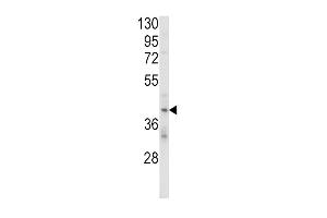 Western blot analysis of KIR2DL4 Antibody (C-term) (ABIN652985 and ABIN2842625) in MDA-M cell line lysates (35 μg/lane). (KIR2DL4/CD158d Antikörper  (C-Term))