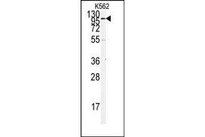 Image no. 1 for anti-Angiotensin I Converting Enzyme 2 (ACE2) (N-Term) antibody (ABIN358574) (ACE2 Antikörper  (N-Term))