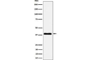 Western blot analysis of NSDHL expression in A431 cell lysate.