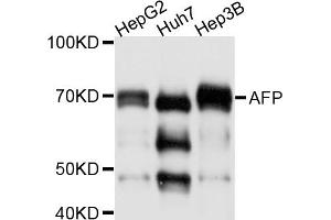 Western blot analysis of extracts of various cell lines, using AFP antibody (ABIN4902853). (alpha Fetoprotein Antikörper)