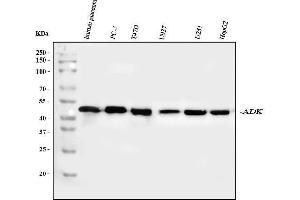 Western blot analysis of ADK using anti-ADK antibody (ABIN4886430). (ADK Antikörper  (AA 165-351))