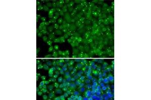 Immunofluorescence analysis of HeLa cells using ARRB2 Polyclonal Antibody (Arrestin 3 Antikörper)