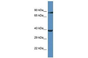 Western Blot showing OR2M5 antibody used at a concentration of 1.