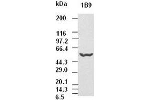 CK8 antibody (1B9) at 1:5000 dilution + Hela cell lysate (KRT8 Antikörper  (AA 91-381))