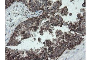 Image no. 7 for anti-NADH Dehydrogenase (Ubiquinone) 1 beta Subcomplex, 10, 22kDa (NDUFB10) antibody (ABIN1499668)