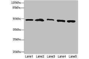 Western blot All lanes: PSMD13antibody at 3. (PSMD13 Antikörper  (Regulatory Subunit 13))