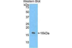 Western Blotting (WB) image for anti-Vasoactive Intestinal Peptide (Vip) (AA 34-157) antibody (ABIN1860940) (Vip Antikörper  (AA 34-157))