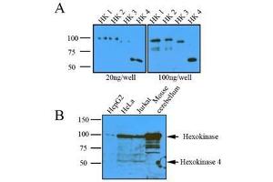 Western Blotting (WB) image for anti-Hexokinase 1 (HK1) (AA 1-917), (N-Term) antibody (ABIN317095)