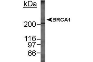 Western blot analysis of BRCA1 in MCF-7 whole cell lysate using BRCA1 monoclonal antibody, clone MU . (BRCA1 Antikörper  (AA 1314-1864))