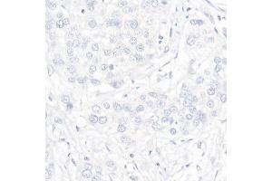 Immunohistochemistry (IHC) image for anti-Progesterone Receptor (PGR) antibody (ABIN7269533)