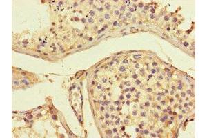Immunohistochemistry of paraffin-embedded human testis tissue using ABIN7143303 at dilution of 1:100 (Adenosine A2a Receptor Antikörper  (AA 291-412))