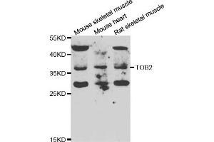 Western blot analysis of extracts of various cell lines, using TOB2 antibody. (TOB2 Antikörper)