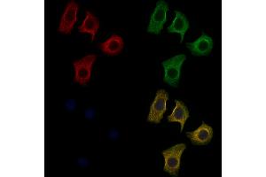ABIN6259561 and ABIN6274852 staining Hela cells by IF/ICC. (C1orf135 Antikörper  (Internal Region))