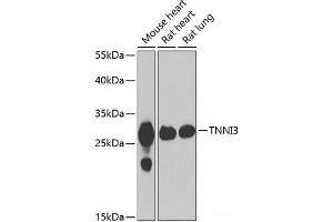 Western blot analysis of extracts of various cell lines using TNNI3 Polyclonal Antibody at dilution of 1:1000. (TNNI3 Antikörper)