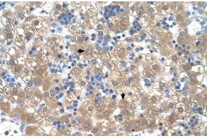 Human Liver (PEX3 Antikörper  (N-Term))