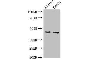Western Blot Positive WB detected in: Mouse kidney tissue, Mouse brain tissue All lanes: GDF11 antibody at 3 μg/mL Secondary Goat polyclonal to rabbit IgG at 1/50000 dilution Predicted band size: 46 kDa Observed band size: 46 kDa (GDF11 Antikörper  (AA 296-404))
