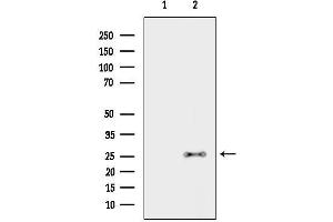 Western blot analysis of lysates from HepG2 cells(heat-shock treatment), using CLEC6A Antibody.