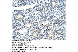 Human Lung (ZNF786 Antikörper  (N-Term))