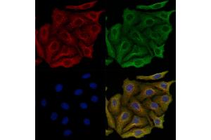ABIN6264024 and ABIN6279643 staining Hela cells by IF/ICC. (PALLD Antikörper  (Internal Region))